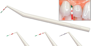 Periodontal Probe Markings