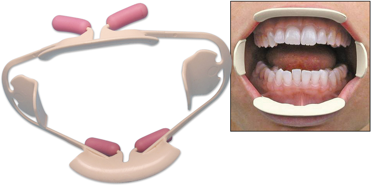 Comfortview® Lip And Cheek Retractor Safco Dental Supply